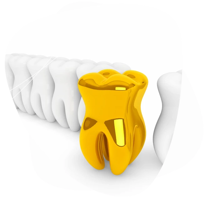 скупка стоматологического золота в Москве